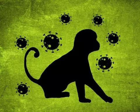 Variole du singe les trois cas suspects à l'île Maurice sont finalement négatifs.